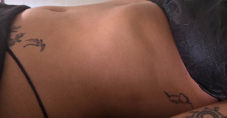The same client's midsection after the session, with reduced swelling